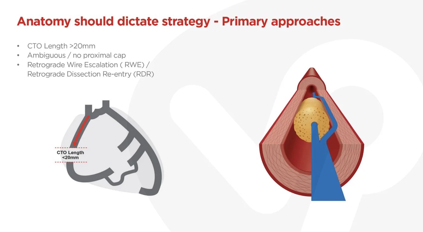 Retrograde wire escalation and dissection re-entry via collaterals